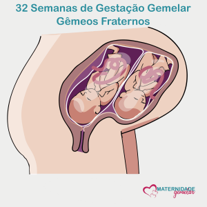 gestação gemelar - 32 semanas