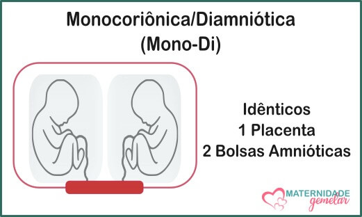 gestação monocoriônica 